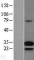 ADM / Adrenomedullin Protein - Western validation with an anti-DDK antibody * L: Control HEK293 lysate R: Over-expression lysate