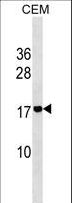 ADM2 / Adrenomedullin 2 Antibody - ADM2 Antibody western blot of CEM cell line lysates (35 ug/lane). The ADM2 antibody detected the ADM2 protein (arrow).