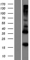 ADM5 / C19orf76 Protein - Western validation with an anti-DDK antibody * L: Control HEK293 lysate R: Over-expression lysate