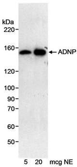ADNP Antibody - Detection of Human ADNP by Western Blot. Samples: Nuclear extract (5 or 20 ug) from HeLa cells. Antibody: Affinity purified rabbit anti-ADNP antibody used at 0.2 ug/ml. Detection: Chemiluminescence with an exposure time of 20 minutes.