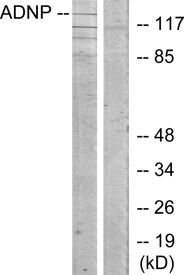 ADNP Antibody - Western blot analysis of lysates from LOVO cells, using ADNP Antibody. The lane on the right is blocked with the synthesized peptide.
