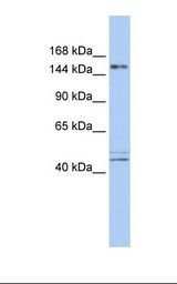 ADNP Antibody - Fetal brain lysate. Antibody concentration: 1.0 ug/ml. Gel concentration: 6-18%.  This image was taken for the unconjugated form of this product. Other forms have not been tested.