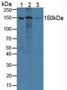 ADNP Antibody - Western Blot; Sample: Lane1: Human Lung Tissue; Lane2: Human Hela Cells; Lane3: Porcine Heart Tissue.