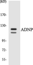 ADNP Antibody - Western blot analysis of the lysates from K562 cells using ADNP antibody.