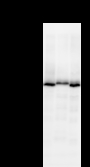 ADNP Antibody - Detection of ADNP by Western blot. Samples: Whole cell lysate from human HEK293 (H, 25 ug) , mouse NIH3T3 (M, 25 ug) and rat F2408 (R, 25 ug) cells. Predicted molecular weight: 123 kDa