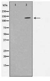 ADNP Antibody - Western blot of LOVO cell lysate using ADNP Antibody