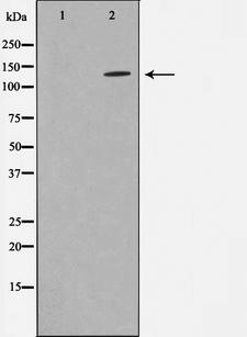 ADNP Antibody - Western blot analysis on LOVO cells cell lysates using ADNP antibody. The lane on the left is treated with the antigen-specific peptide.