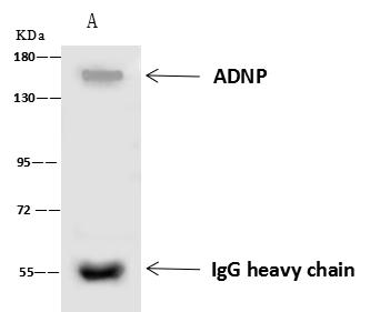 ADNP Antibody - ADNP was immunoprecipitated using: Lane A: 0.5 mg U-251MG Whole Cell Lysate. 4 uL anti-ADNP rabbit polyclonal antibody and 60 ug of Immunomagnetic beads Protein A/G. Primary antibody: Anti-ADNP rabbit polyclonal antibody, at 1:100 dilution. Secondary antibody: Goat Anti-Rabbit IgG (H+L)/HRP at 1/10000 dilution. Developed using the ECL technique. Performed under reducing conditions. Predicted band size: 122 kDa. Observed band size: 150 kDa.