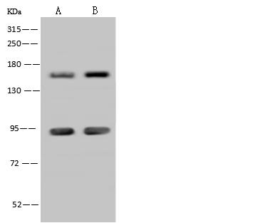 ADNP Antibody - Anti-ADNP rabbit polyclonal antibody at 1:500 dilution. Lane A: Hela Whole Cell Lysate. Lane B: U-251 MG Whole Cell Lysate. Lysates/proteins at 30 ug per lane. Secondary: Goat Anti-Rabbit IgG (H+L)/HRP at 1/10000 dilution. Developed using the ECL technique. Performed under reducing conditions. Predicted band size: 122 kDa. Observed band size: 150 kDa.