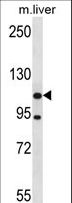 ADNP2 Antibody - ADNP2 Antibody western blot of mouse liver tissue lysates (35 ug/lane). The ADNP2 antibody detected the ADNP2 protein (arrow).