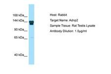ADNP2 Antibody -  This image was taken for the unconjugated form of this product. Other forms have not been tested.