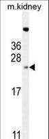 ADO Antibody - ADO Antibody western blot of mouse kidney tissue lysates (35 ug/lane). The ADO antibody detected the ADO protein (arrow).