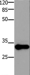ADO Antibody - Western blot analysis of Mouse testis tissue, using ADO Polyclonal Antibody at dilution of 1:1200.