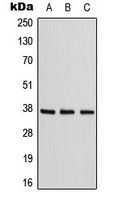 ADORA1 / Adenosine A1 Receptor Antibody - Western blot analysis of Adenosine A1 Receptor expression in HepG2 (A); NIH3T3 (B); rat kidney (C) whole cell lysates.