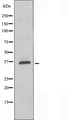 ADORA1 / Adenosine A1 Receptor Antibody - Western blot analysis of extracts of MCF-7 cells using ADORA1 antibody.