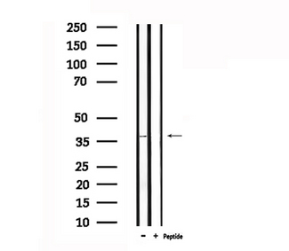 ADORA1 / Adenosine A1 Receptor Antibody - Western blot analysis of extracts of rat muscle using ADORA1 antibody.