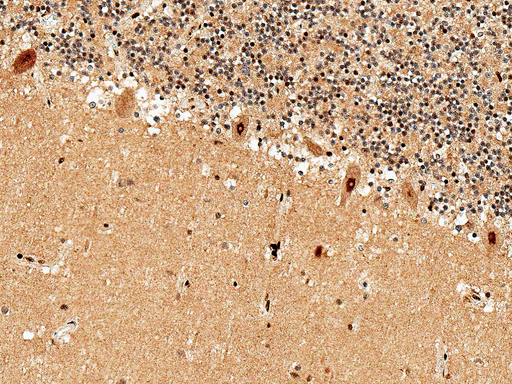 ADORA1 / Adenosine A1 Receptor Antibody - Immunohistochemistry analysis using Rabbit Anti-Adenosine receptor A1 Polyclonal Antibody. Tissue: Cerebellum. Species: Human. Fixation: Formalin Fixed Paraffin-Embedded. Primary Antibody: Rabbit Anti-Adenosine receptor A1 Polyclonal Antibody  at 1:50 for 30 min at RT. Counterstain: Hematoxylin. Magnification: 20X.