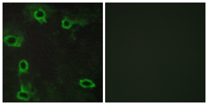 ADORA2A/Adenosine A2A Receptor Antibody - Immunofluorescence analysis of COS7 cells, using ADORA2A Antibody. The picture on the right is blocked with the synthesized peptide.