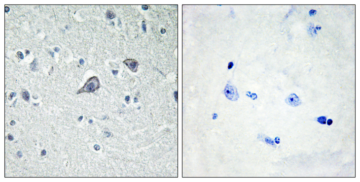 ADORA2A/Adenosine A2A Receptor Antibody - Immunohistochemistry analysis of paraffin-embedded human brain tissue, using ADORA2A Antibody. The picture on the right is blocked with the synthesized peptide.