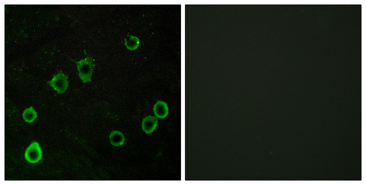 ADORA2A/Adenosine A2A Receptor Antibody - Immunofluorescence analysis of LOVO cells, using ADORA2A Antibody. The picture on the right is blocked with the synthesized peptide.