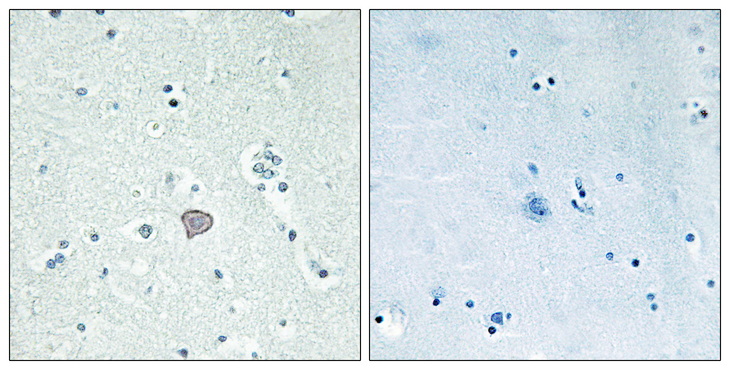 ADORA2A/Adenosine A2A Receptor Antibody - Immunohistochemistry analysis of paraffin-embedded human brain tissue, using ADORA2A Antibody. The picture on the right is blocked with the synthesized peptide.