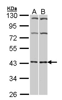ADORA2A/Adenosine A2A Receptor Antibody - Sample (30 ug of whole cell lysate). A: Hela, B: Molt-4 . 10% SDS PAGE. A2a Receptor / ADORA2A antibody diluted at 1:1000.