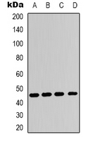 ADORA2A/Adenosine A2A Receptor Antibody - Western blot analysis of Adenosine A2a Receptor expression in HeLa (A); HepG2 (B); NIH3T3 (C); H9C2 (D) whole cell lysates.