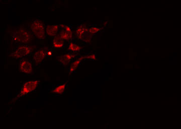 ADORA2A/Adenosine A2A Receptor Antibody - Staining HeLa cells by IF/ICC. The samples were fixed with PFA and permeabilized in 0.1% Triton X-100, then blocked in 10% serum for 45 min at 25°C. The primary antibody was diluted at 1:200 and incubated with the sample for 1 hour at 37°C. An Alexa Fluor 594 conjugated goat anti-rabbit IgG (H+L) antibody, diluted at 1/600, was used as secondary antibody.