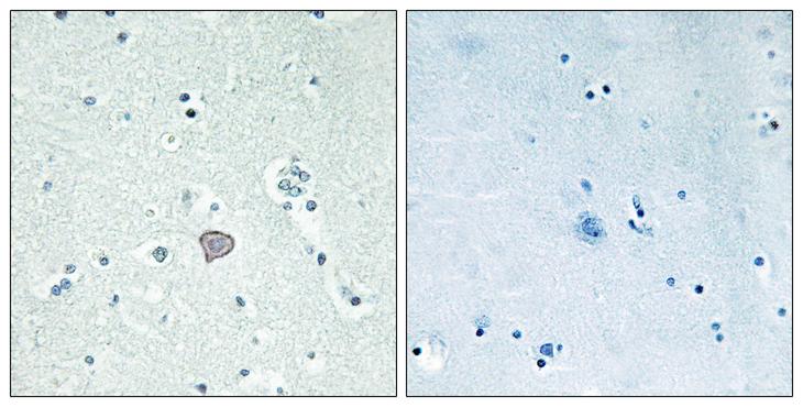ADORA2A/Adenosine A2A Receptor Antibody - Peptide - + Immunohistochemistry analysis of paraffin-embedded human brain tissue using ADORA2A antibody.