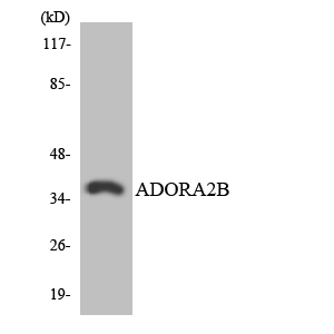 ADORA2B/Adenosine A2B Receptor Antibody - Western blot analysis of the lysates from HT-29 cells using ADORA2B antibody.