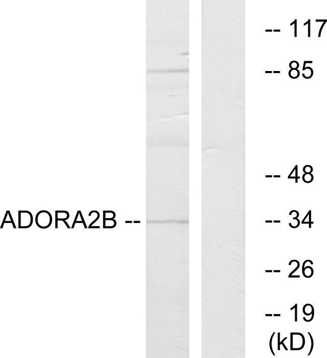 ADORA2B/Adenosine A2B Receptor Antibody - Western blot analysis of lysates from Jurkat cells, using ADORA2B Antibody. The lane on the right is blocked with the synthesized peptide.