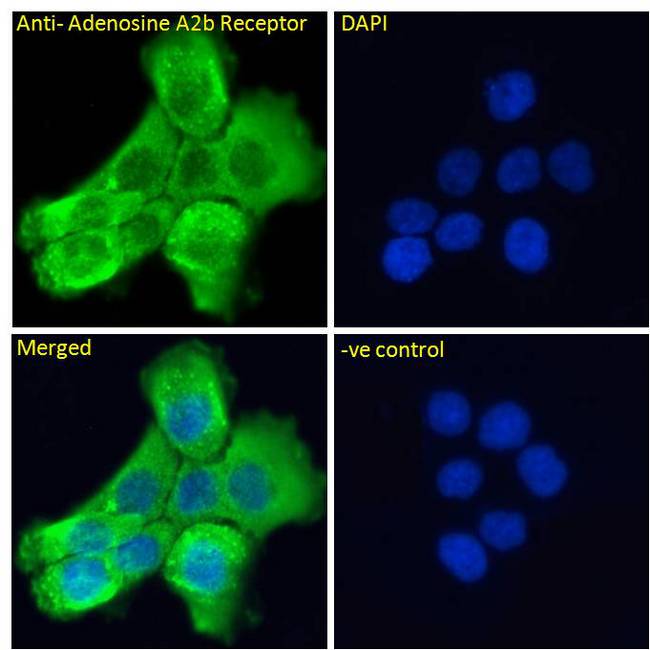 ADORA2B/Adenosine A2B Receptor Antibody - ADORA2B/Adenosine A2B Receptor antibody immunofluorescence analysis of paraformaldehyde fixed A431 cells, permeabilized with 0.15% Triton. Primary incubation 1hr (10ug/ml) followed by Alexa Fluor 488 secondary antibody (2ug/ml), showing cytoplasmic staining. The nuclear stain is DAPI (blue). Negative control: Unimmunized goat IgG (10ug/ml) followed by Alexa Fluor 488 secondary antibody (2ug/ml).