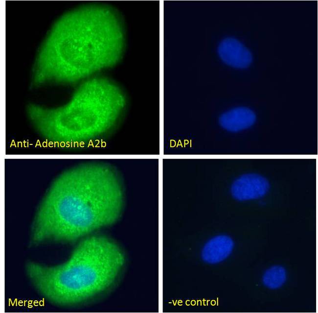 ADORA2B/Adenosine A2B Receptor Antibody - ADORA2B/Adenosine A2B Receptor antibody immunofluorescence analysis of paraformaldehyde fixed U2OS cells, permeabilized with 0.15% Triton. Primary incubation 1hr (10ug/ml) followed by Alexa Fluor 488 secondary antibody (2ug/ml), showing cytoplasmic staining. The nuclear stain is DAPI (blue). Negative control: Unimmunized goat IgG (10ug/ml) followed by Alexa Fluor 488 secondary antibody (2ug/ml).