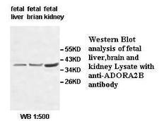 ADORA2B/Adenosine A2B Receptor Antibody