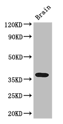 ADORA2B/Adenosine A2B Receptor Antibody - Positive WB detected in:Mouse brain tissue;All lanes: ADORA2B antibody at 3ug/ml;Secondary;Goat polyclonal to rabbit IgG at 1/50000 dilution;Predicted band size: 37 kDa;Observed band size: 37 kDa;