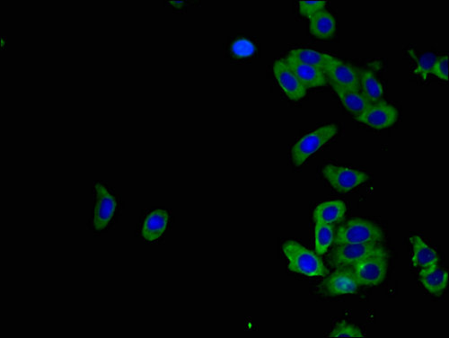 ADORA2B/Adenosine A2B Receptor Antibody - Immunofluorescent analysis of HepG2 cells using ADORA2B Antibody at a dilution of 1:100 and Alexa Fluor 488-congugated AffiniPure Goat Anti-Rabbit IgG(H+L)