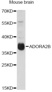 ADORA2B/Adenosine A2B Receptor Antibody - Western blot analysis of extracts of mouse brain, using ADORA2B antibody at 1:1000 dilution. The secondary antibody used was an HRP Goat Anti-Rabbit IgG (H+L) at 1:10000 dilution. Lysates were loaded 25ug per lane and 3% nonfat dry milk in TBST was used for blocking. An ECL Kit was used for detection and the exposure time was 30s.