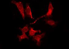 ADORA2B/Adenosine A2B Receptor Antibody - Staining HeLa cells by IF/ICC. The samples were fixed with PFA and permeabilized in 0.1% Triton X-100, then blocked in 10% serum for 45 min at 25°C. The primary antibody was diluted at 1:200 and incubated with the sample for 1 hour at 37°C. An Alexa Fluor 594 conjugated goat anti-rabbit IgG (H+L) Ab, diluted at 1/600, was used as the secondary antibody.