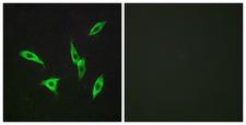 ADORA2B/Adenosine A2B Receptor Antibody - Peptide - + Immunofluorescence analysis of LOVO cells, using ADORA2B antibody.