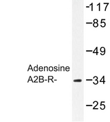 ADORA2B/Adenosine A2B Receptor Antibody - Western blot of Adenosine A2B-R (W270) pAb in extracts from J Jurkat cells.