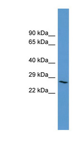 ADORA3 / Adenosine A3 Receptor Antibody - ADORA3 antibody Western blot of Fetal Lung lysate.  This image was taken for the unconjugated form of this product. Other forms have not been tested.