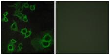 ADORA3 / Adenosine A3 Receptor Antibody - Immunofluorescence analysis of COS7 cells, using ADORA3 Antibody. The picture on the right is blocked with the synthesized peptide.