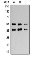 ADORA3 / Adenosine A3 Receptor Antibody - Western blot analysis of Adenosine A3 Receptor expression in HeLa (A); SP20 (B); PC12 (C) whole cell lysates.