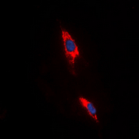 ADORA3 / Adenosine A3 Receptor Antibody - Immunofluorescent analysis of Adenosine A3 Receptor staining in HeLa cells. Formalin-fixed cells were permeabilized with 0.1% Triton X-100 in TBS for 5-10 minutes and blocked with 3% BSA-PBS for 30 minutes at room temperature. Cells were probed with the primary antibody in 3% BSA-PBS and incubated overnight at 4 ??C in a humidified chamber. Cells were washed with PBST and incubated with a DyLight 594-conjugated secondary antibody (red) in PBS at room temperature in the dark. DAPI was used to stain the cell nuclei (blue).