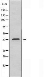 ADORA3 / Adenosine A3 Receptor Antibody - Western blot analysis of extracts of HepG2 cells using ADORA3 antibody.