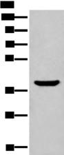 ADORA3 / Adenosine A3 Receptor Antibody - Western blot analysis of Mouse liver tissue lysate  using ADORA3 Polyclonal Antibody at dilution of 1:400