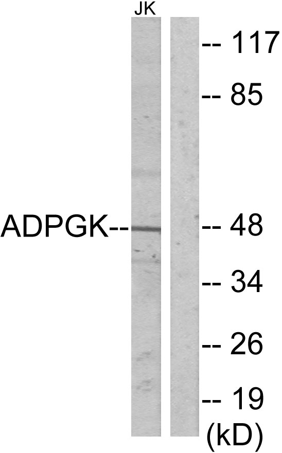 ADPGK Antibody - Western blot analysis of lysates from Jurkat cells, using ADPGK Antibody. The lane on the right is blocked with the synthesized peptide.