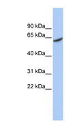ADPGK Antibody - ADPGK antibody Western blot of MCF7 cell lysate. This image was taken for the unconjugated form of this product. Other forms have not been tested.