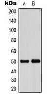 ADPGK Antibody - Western blot analysis of ADPGK expression in HeLa (A); VEC (B) whole cell lysates.