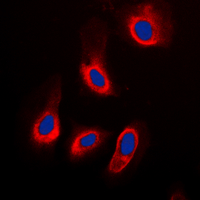 ADPGK Antibody - Immunofluorescent analysis of ADPGK staining in HeLa cells. Formalin-fixed cells were permeabilized with 0.1% Triton X-100 in TBS for 5-10 minutes and blocked with 3% BSA-PBS for 30 minutes at room temperature. Cells were probed with the primary antibody in 3% BSA-PBS and incubated overnight at 4 C in a humidified chamber. Cells were washed with PBST and incubated with a DyLight 594-conjugated secondary antibody (red) in PBS at room temperature in the dark. DAPI was used to stain the cell nuclei (blue).